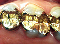 Gold