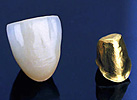 Galvano